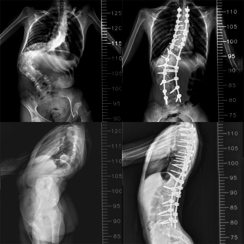 Blank 4 Grids Collage